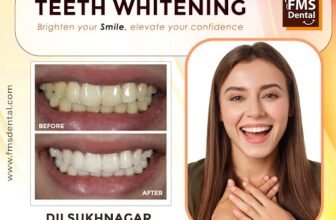 Teeth Whitening Treatment in Dilsukhnagar – Brighten Your Smile with FMS Dental