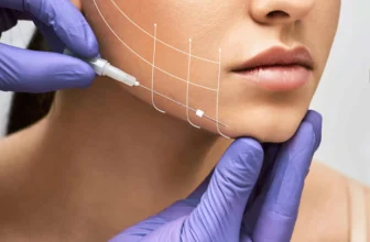 Is Thread Lift Better Than Botox or Fillers? | Expert Comparison