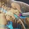 How Can Facet Joint Injections in the UK Help Relieve Back Pain?