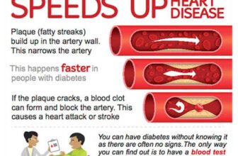 Diabetes and Heart Disease