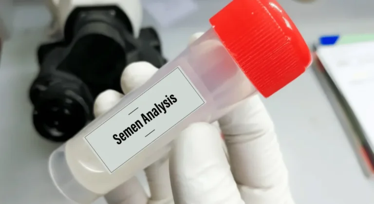 Semen Analysis in Ludhiana for Male Fertility Testing