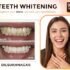 The Complete Guide to Advanced Dental Care in Kochi: Elevating Your Smile with Dr. Ajith Soman