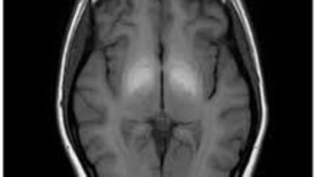 What Can a Brain MRI Really Reveal? The Scan Every Patient Should Know About