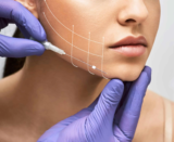 Is Thread Lift Better Than Botox or Fillers? | Expert Comparison