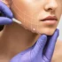 All-on-4 vs All-on-6 vs All-on-8 Implants – Which Is Best for You? Expert Advice